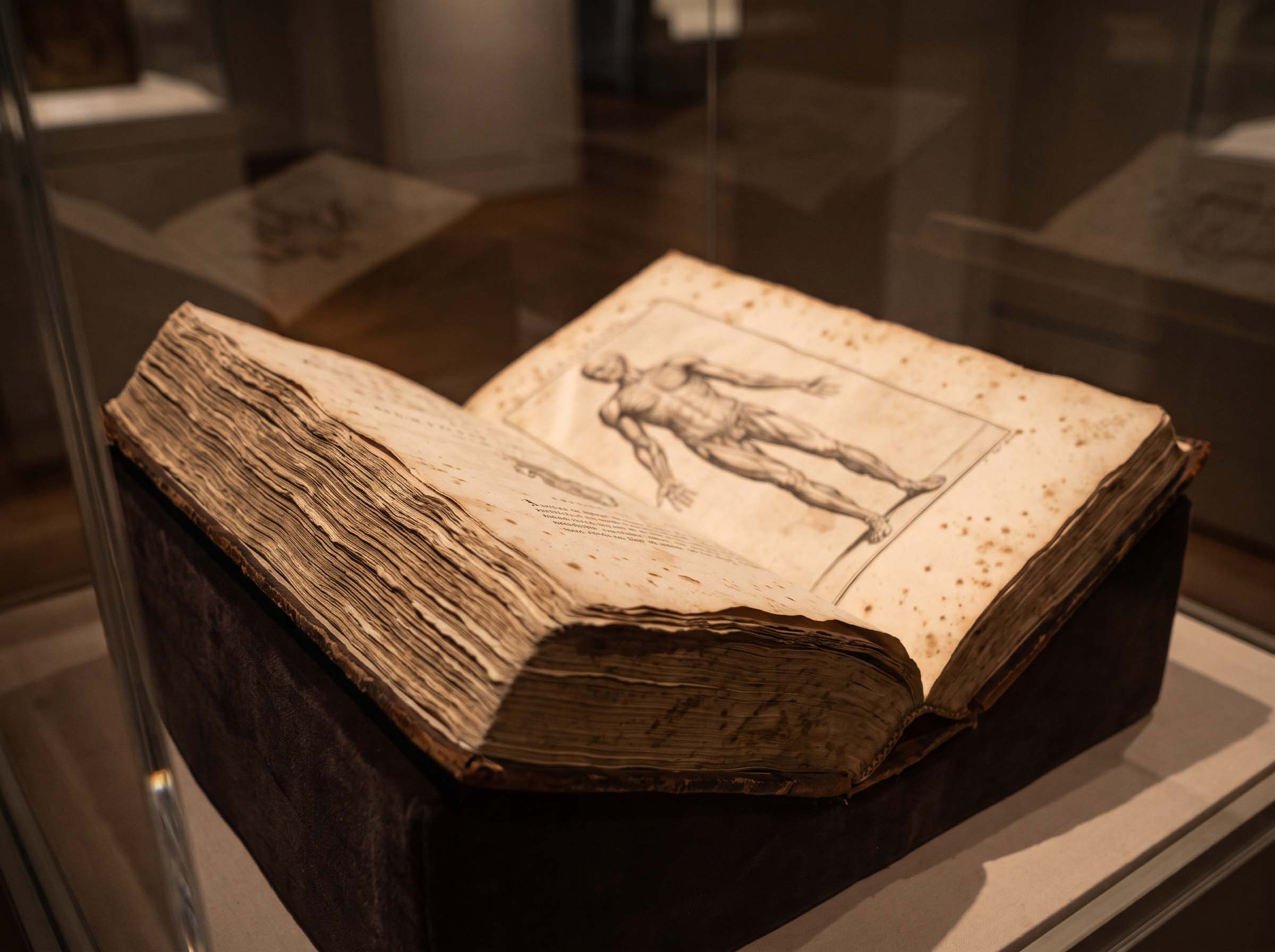 An eighteenth-century anatomical atlas lying open under low gallery light, showing an engraved figure plate