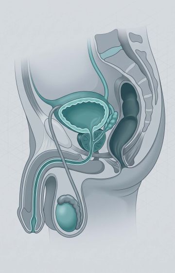 Medical 3D vector diagram showing male pelvic anatomy and internal tissue structures.